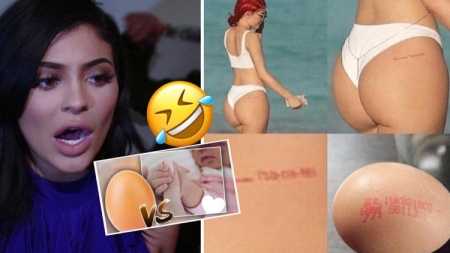 E bardha e vezës është botoksi i ri! Nuk na besoni? Ja si ta përdorni dhe do të shihni rezultatet